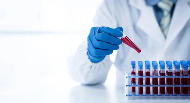 Close-up of blood samples for longevity lab testing for men